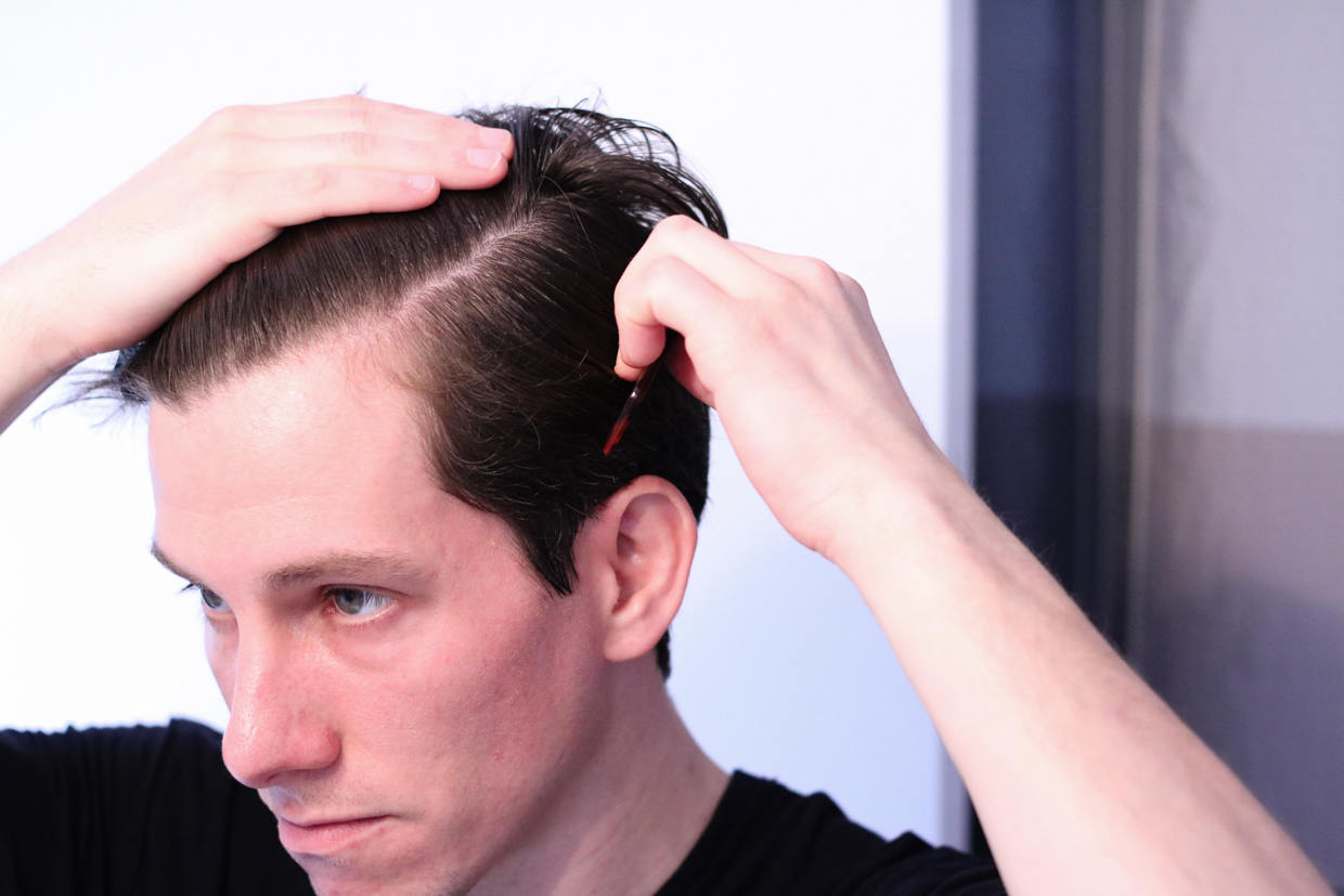 Как убрать волосы на висках у мужчин